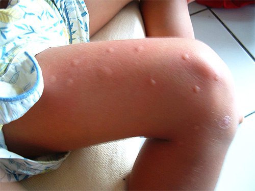 Как спасти ребенка от комаров?